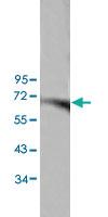 Anti-ANGPTL6 Rabbit Polyclonal Antibody