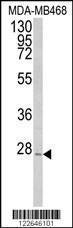 Anti-PEX11A Rabbit Polyclonal Antibody (AP (Alkaline Phosphatase))