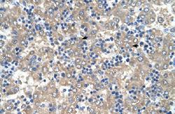 Anti-C3orf10 Rabbit Polyclonal Antibody