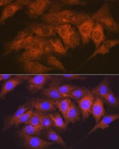 Immunofluorescence analysis of C6 cells using Anti-CaMKII delta Antibody [ARC1473] (A307051) at a dilution of 1:100 (40x lens). DAPI was used to stain the cell nuclei (blue)