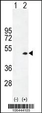 Anti-CKB Rabbit Polyclonal Antibody