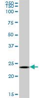 Anti-MS4A12 Mouse Polyclonal Antibody