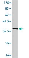 Anti-GHRL Mouse Monoclonal Antibody [clone: 2F2]