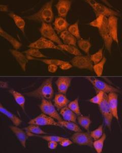 Immunofluorescence analysis of NIH-3T3 cells using Anti-CaMKII delta Antibody [ARC1473] (A307051) at a dilution of 1:100 (40x lens). DAPI was used to stain the cell nuclei (blue)