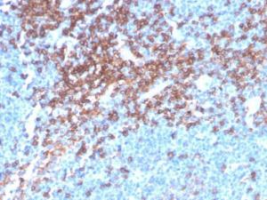 Immunohistochemical analysis of formalin-fixed, paraffin-embedded human lymph node using Anti-CD4 Antibody [rCD4/3930]