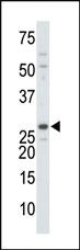 Anti-DTYMK Rabbit Polyclonal Antibody