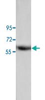 Anti-ANXA11 Rabbit Polyclonal Antibody