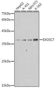 Anti-RRP42 Rabbit Monoclonal Antibody [clone: ARC2510]