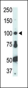 Anti-FER Rabbit Polyclonal Antibody (Biotin)