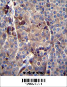 Anti-PRAMEF8 Rabbit Polyclonal Antibody (AP (Alkaline Phosphatase))