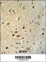 Anti-IRGQ Rabbit Polyclonal Antibody (HRP (Horseradish Peroxidase))