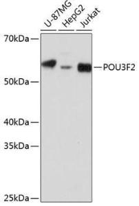 Western blot analysis of extracts of various cell lines, using Anti-Brn-2 Antibody (A307053) at 1:1,000 dilution. The secondary antibody was Goat Anti-Rabbit IgG H&L Antibody (HRP) at 1:10,000 dilution.