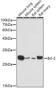 Western blot analysis of extracts of various cell lines, using Anti-Bcl-2 Antibody (A308149) at 1:500 dilution