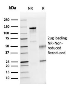 SDS-PAGE analysis of Anti-Dystrophin Antibody [DMD/3241] under non-reduced and reduced conditions; showing intact IgG and intact heavy and light chains, respectively. SDS-PAGE analysis confirms the integrity and purity of the antibody.