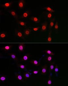 Immunofluorescence analysis of NIH/3T3 cells using Anti-WDR46 Antibody (A305665) at a dilution of 1:50 (40x lens). DAPI was used to stain the cell nuclei (blue)