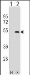 Anti-LYVE1 Rabbit Polyclonal Antibody