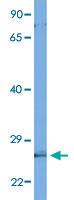 Anti-C4BPB Rabbit Polyclonal Antibody