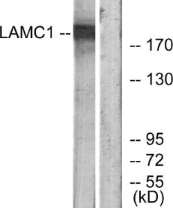 Anti-LAMC1 antibody