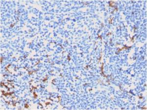 Immunohistochemical analysis of formalin-fixed, paraffin-embedded human tonsil using Anti-CD163 Antibody [M130/2162]