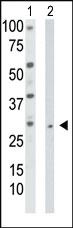 Anti-TK2 Rabbit Polyclonal Antibody