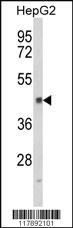 Anti-HPD Rabbit Polyclonal Antibody