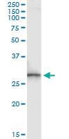 Anti-SPR Antibody Pair