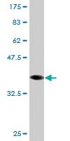 Anti-RNF2 Mouse Monoclonal Antibody [clone: 4A12]