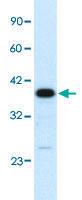 Anti-C4BPB Rabbit Polyclonal Antibody