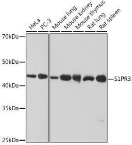 Western blot analysis of extracts of various cell lines, using Anti-EDG3/S1P3 Antibody [ARC1877] (A307055) at 1:1000 dilution. The secondary Antibody was Goat Anti-Rabbit IgG H&L Antibody (HRP) at 1:10000 dilution. Lysates/proteins were present at 25 µg per lane