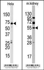 Anti-JMJD4 Rabbit Polyclonal Antibody (HRP (Horseradish Peroxidase))