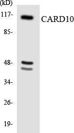 Western blot analysis of the lysates from HeLa cells using Anti-CARD10 Antibody