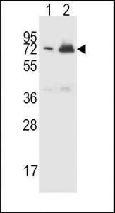 Anti-CFHR5 Rabbit Polyclonal Antibody (PE (Phycoerythrin))