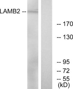 Antibody anti-LAMB2 A97432-100 100 µg