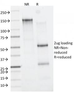 SDS-PAGE analysis of Anti-CD163 Antibody [M130/2162] under non-reduced and reduced conditions; showing intact IgG and intact heavy and light chains, respectively. SDS-PAGE analysis confirms the integrity and purity of the antibody