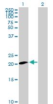 Anti-CLDN20 Mouse Polyclonal Antibody