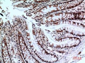 Anti-NCR2 antibody