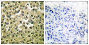 Anti-MCL1 antibody