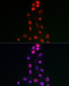 Immunofluorescence analysis of PC-12 cells using Anti-WDR46 Antibody (A305665) at a dilution of 1:50 (40x lens). DAPI was used to stain the cell nuclei (blue)