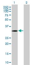 Anti-ITPK1 Mouse Polyclonal Antibody