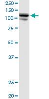 Anti-CC2D1A Mouse Polyclonal Antibody