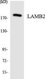 Western blot analysis of the lysates from HepG2 cells using Anti-LAMB2 Antibody