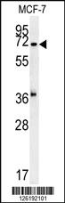 Anti-CCZ1 Rabbit Polyclonal Antibody