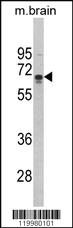 Anti-OR52H1 Rabbit Polyclonal Antibody