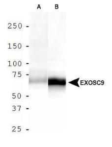 Anti-EXOSC9 Rabbit Polyclonal Antibody