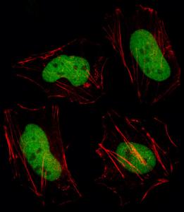 Anti-HDAC1 Rabbit polyclonal antibody