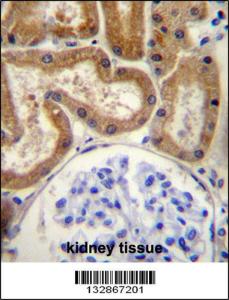 Anti-FGD2 Rabbit Polyclonal Antibody (FITC (Fluorescein Isothiocyanate))