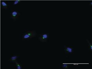 Anti-ACBD3 Mouse Monoclonal Antibody [clone: 2H2]