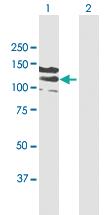 Anti-CC2D1A Mouse Polyclonal Antibody