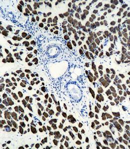 Anti-ACTA1 Mouse Monoclonal Antibody (APC (Allophycocyanin)) [clone: 337CT30.10.1]