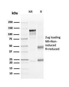 SDS-PAGE analysis of Anti-CD4 Antibody [rCD4/3930] under non-reduced and reduced conditions; showing intact IgG and intact heavy and light chains, respectively. SDS-PAGE analysis confirms the integrity and purity of the antibody.